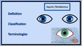 Squint  Definition Classification amp Terminologies [upl. by Acirehs940]