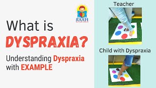 What is DYSPRAXIA   Signs amp Symptoms Explained with Examples  Developmental Coordination Disorder [upl. by Aicila]