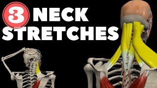 Neck Stretches for Instant pain relief [upl. by Etteragram931]