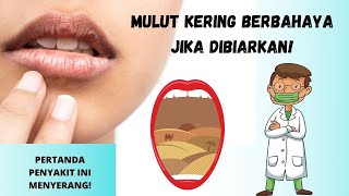 Mulut Sering Kering Ketahui Penyebabnya Ini [upl. by Youlton418]