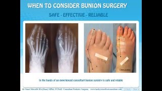 Bunion surgery  Information for patients [upl. by Siryt]