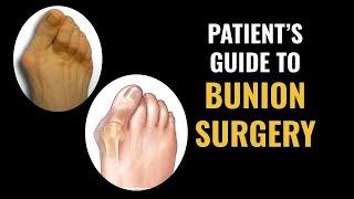 Patients Guide to Bunion Surgery [upl. by Jollanta]