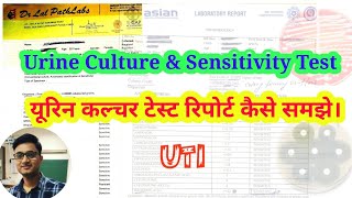 Urine Culture Test in Hindi  How to Read Urine Culture Test Report [upl. by Eelyrag835]