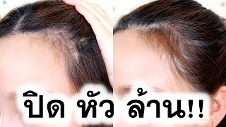 ทำลูกผมปิดหัวล้าน  iamlittlea [upl. by Nawj]