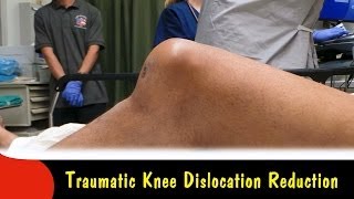 dislocated knee or patella [upl. by Avonasac945]