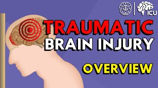 Overview of Traumatic Brain Injury TBI [upl. by Zipnick]