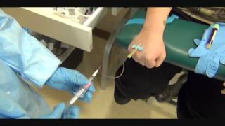 Butterfly Hand Phlebotomy Outside Vein Activationwmv [upl. by Arjan400]